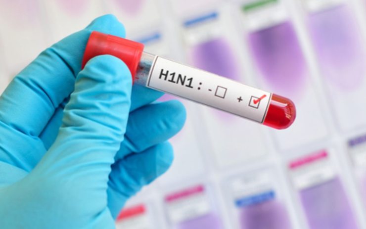 Virus H1N1